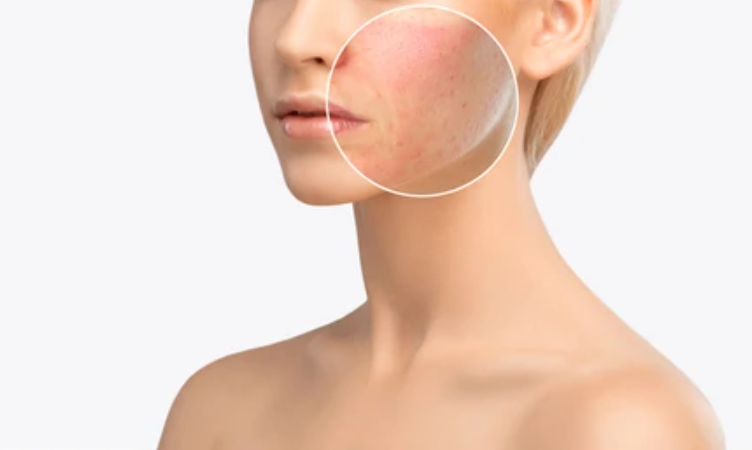 Effective Techniques for Scar Correction